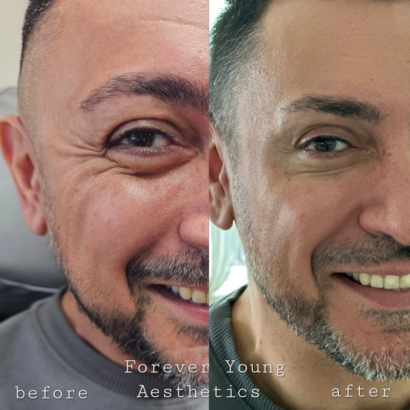 Before & After 2