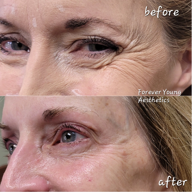 Before & After