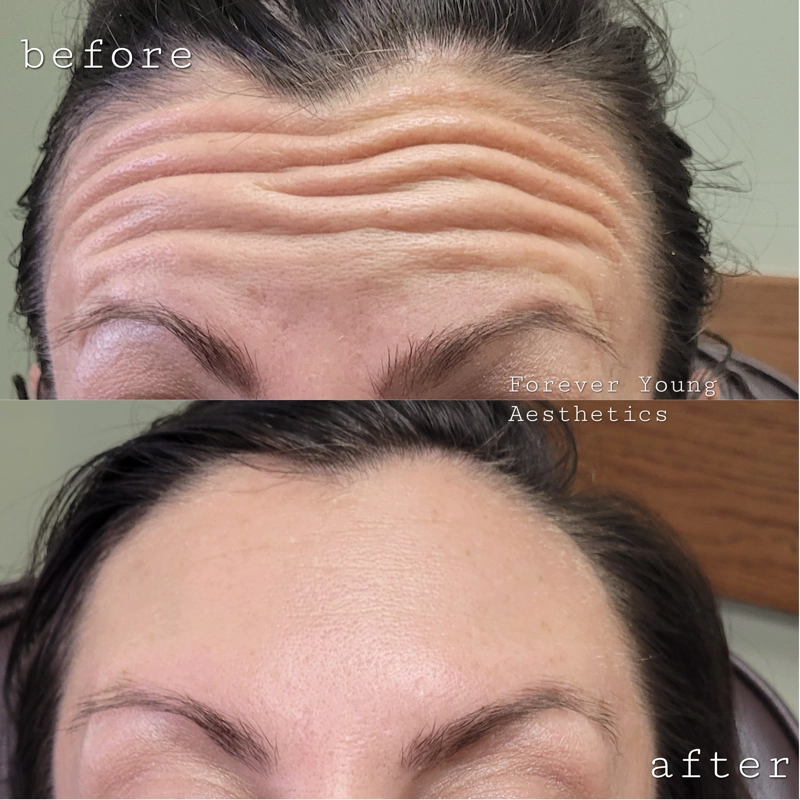 Before & After 4
