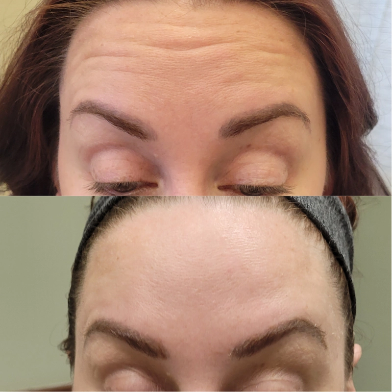 Before & After 3
