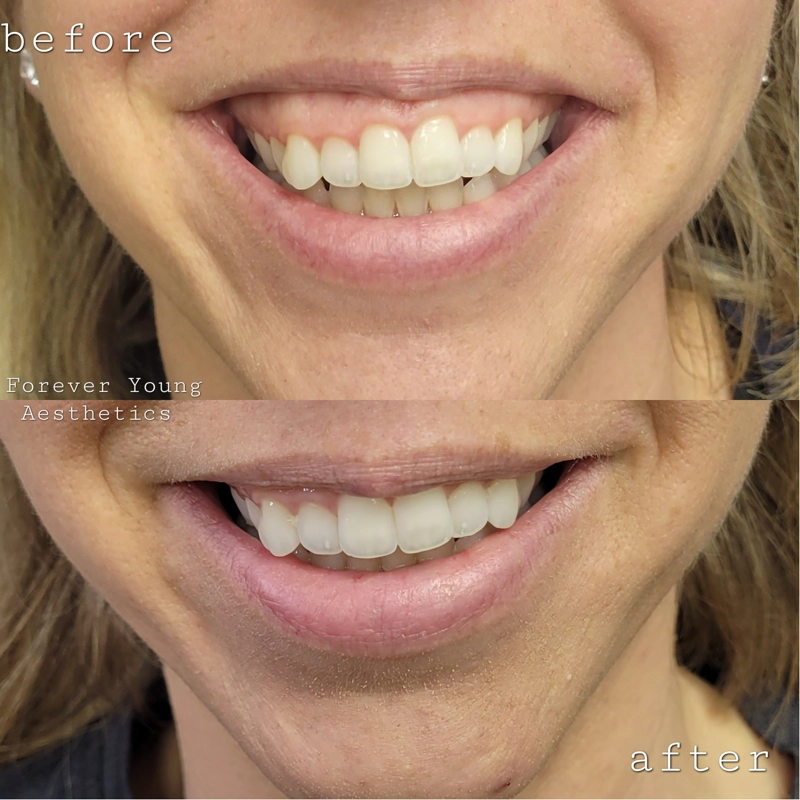 Before & After 6