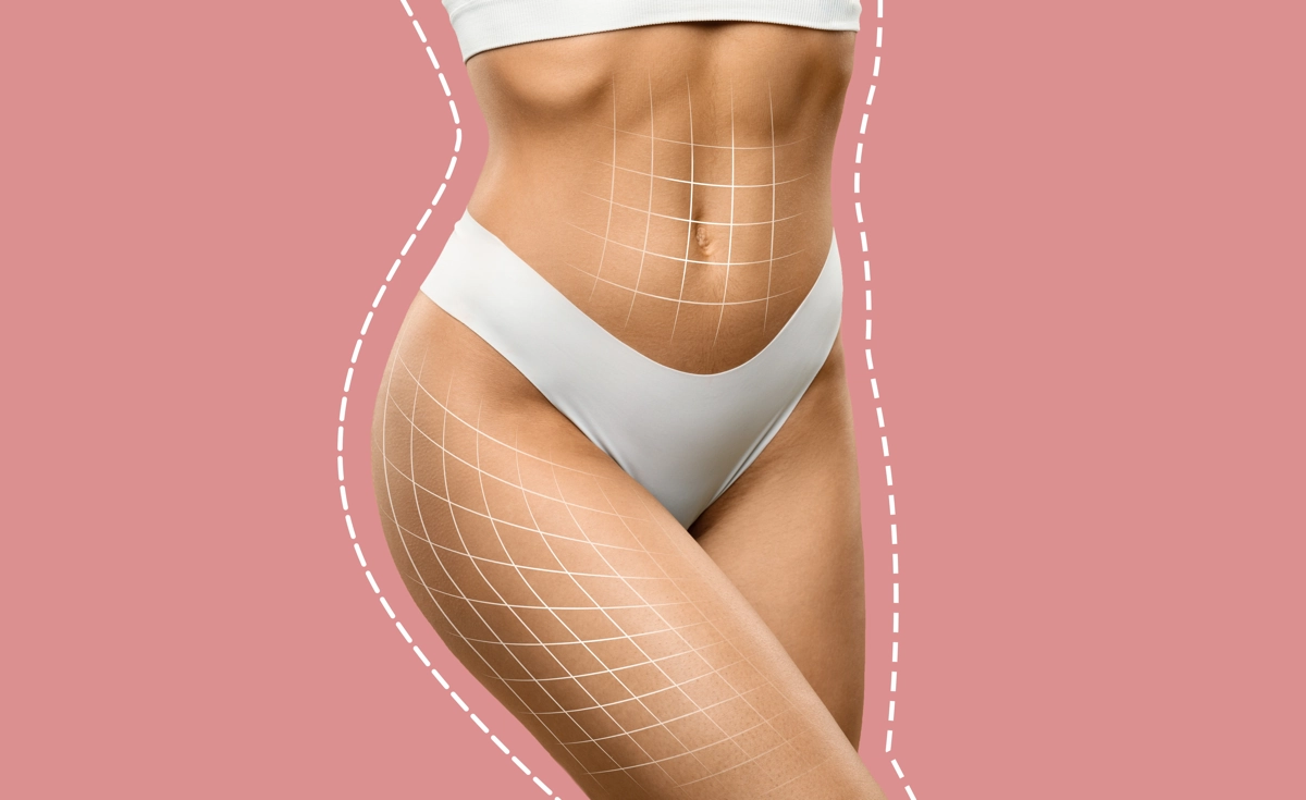 body shape