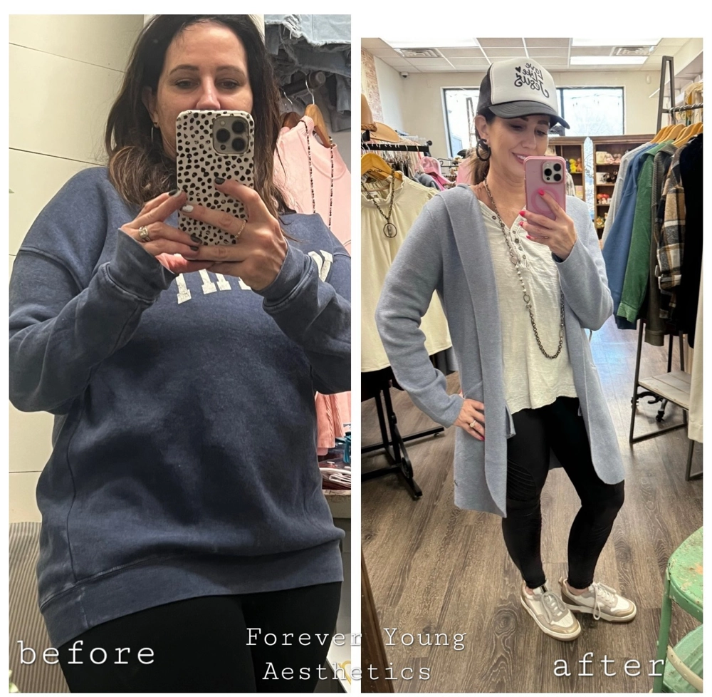 before & after 36