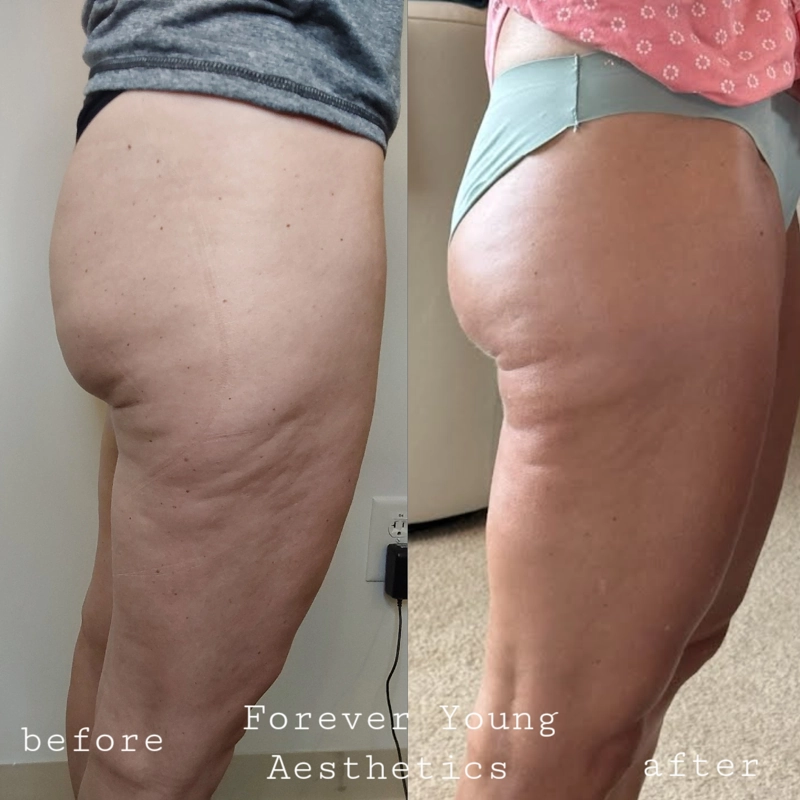 before & After 6