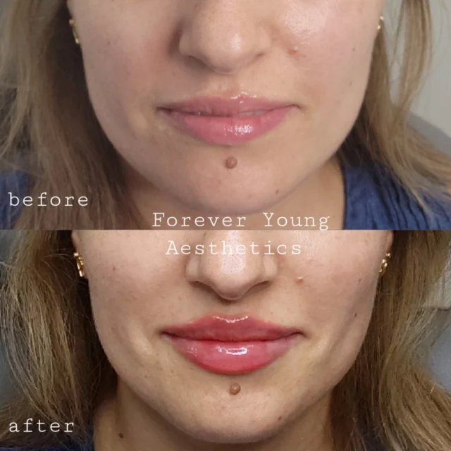 before & after