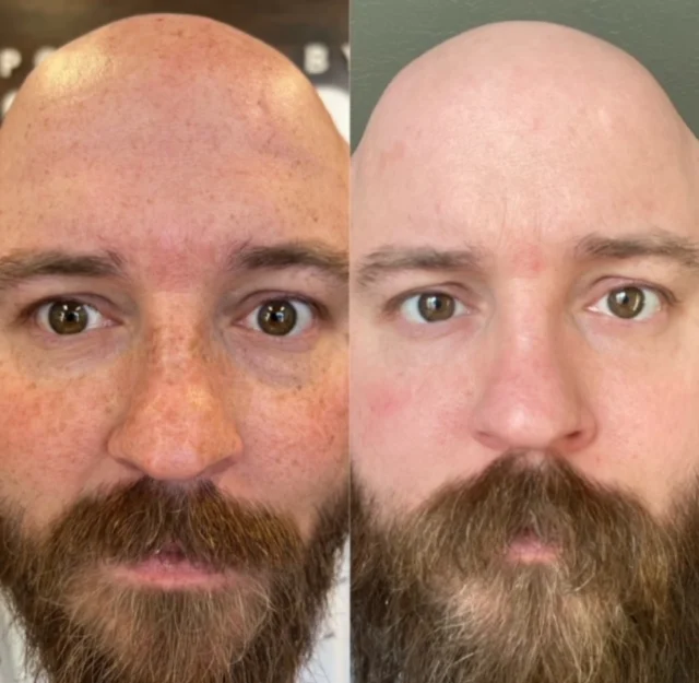 before & after 29
