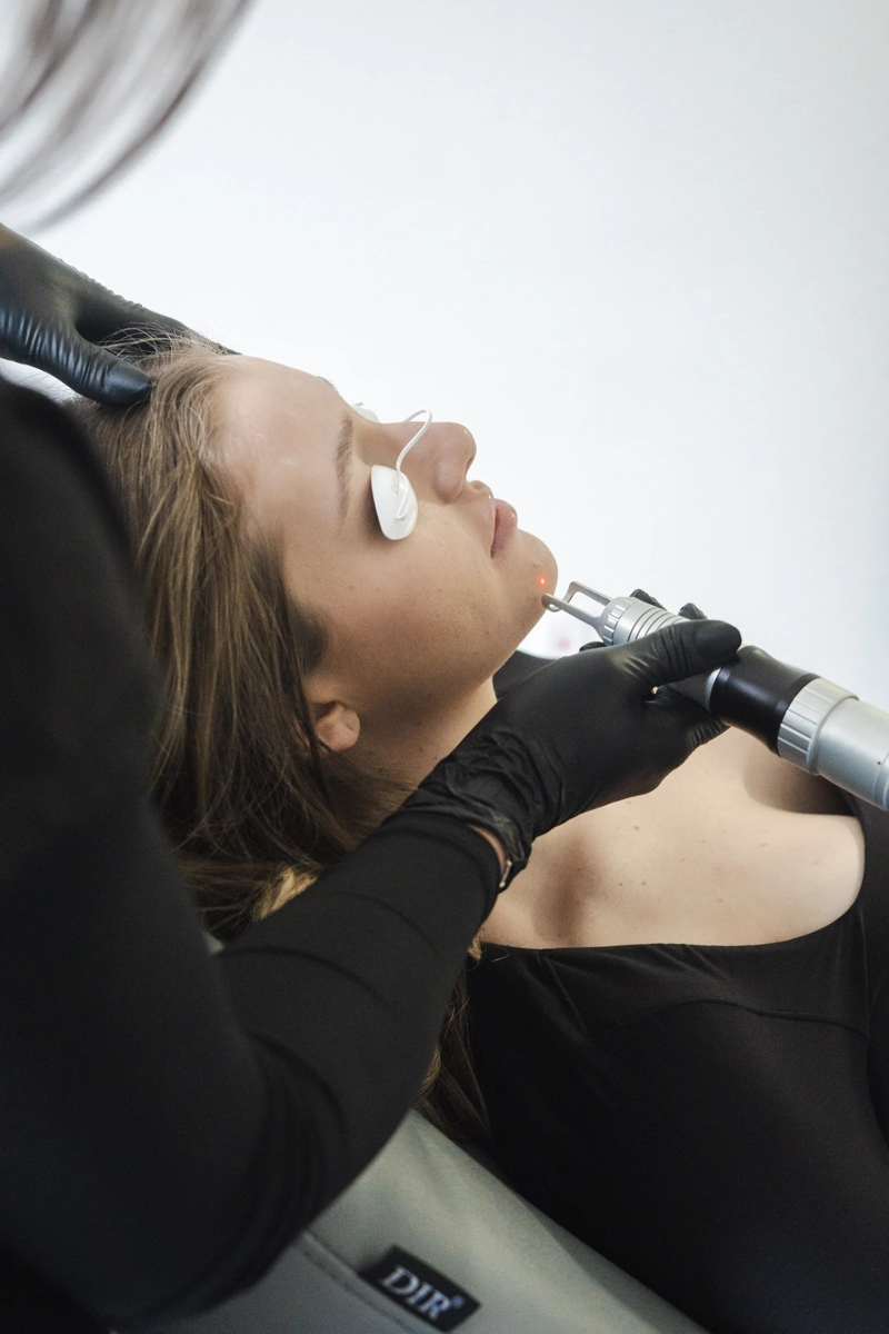 face laser 7