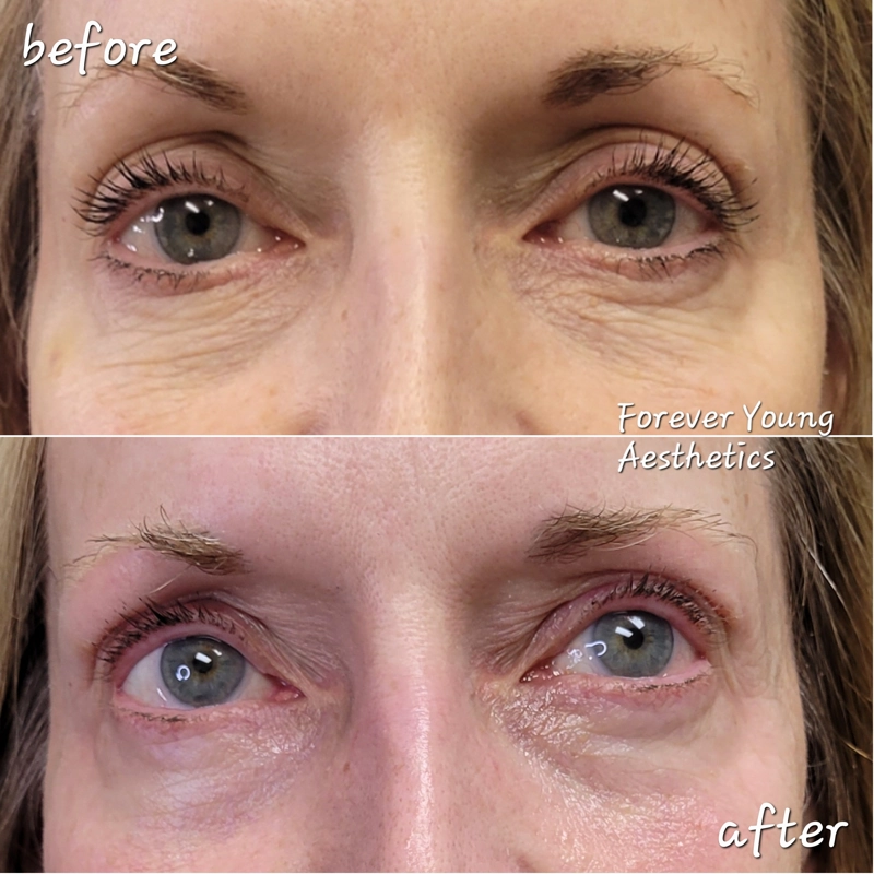 before & after 34