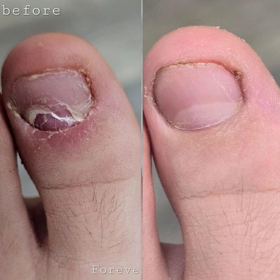 before & After 33