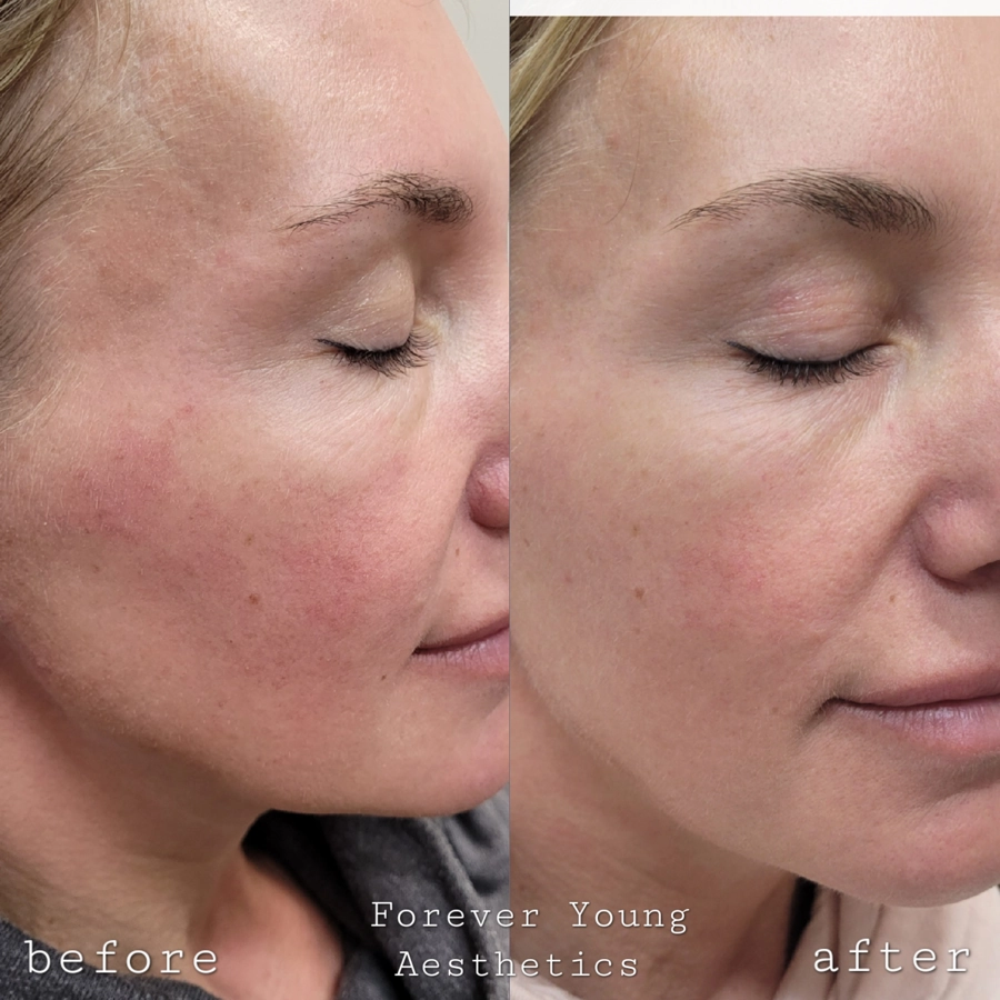 before & After 31