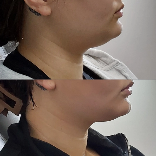 before & after 27