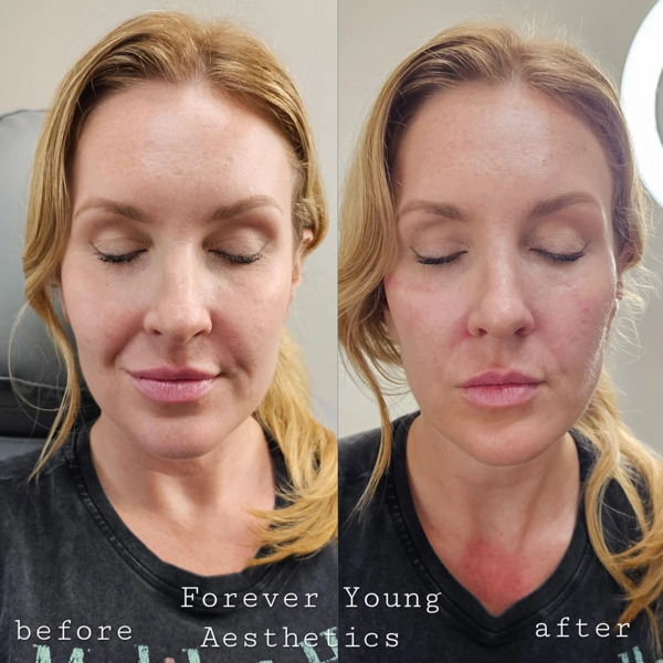 before & after 26