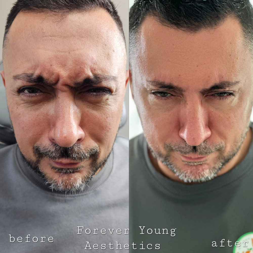 before & after 37