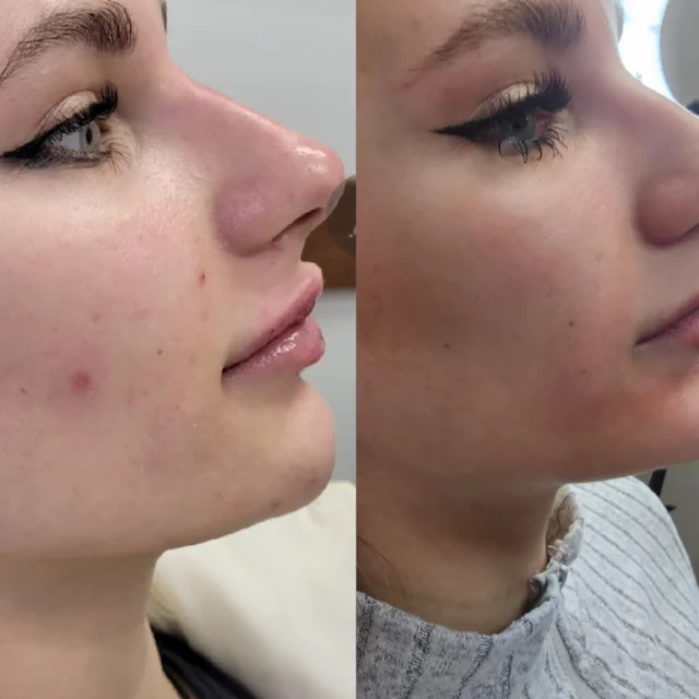 eyelash extension