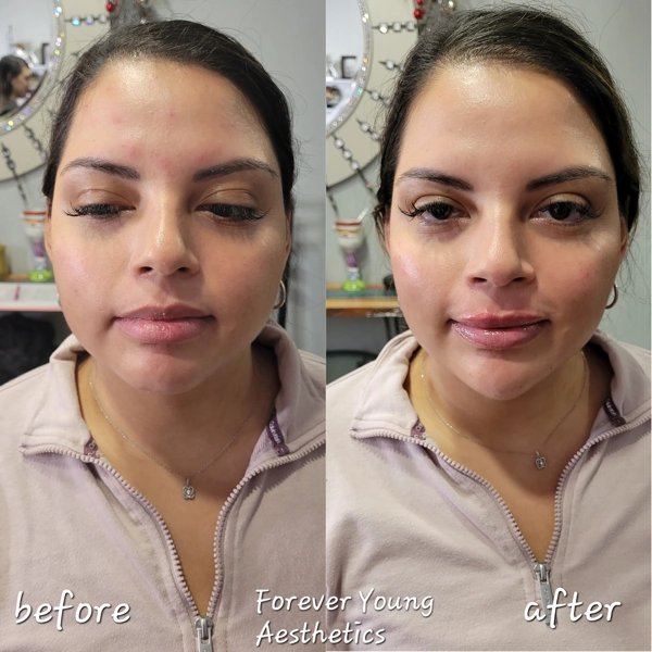before & after 24