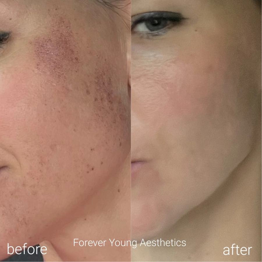 before & after 40