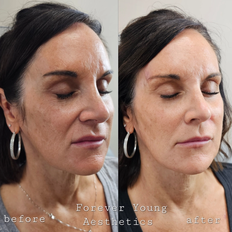 Before & After 8