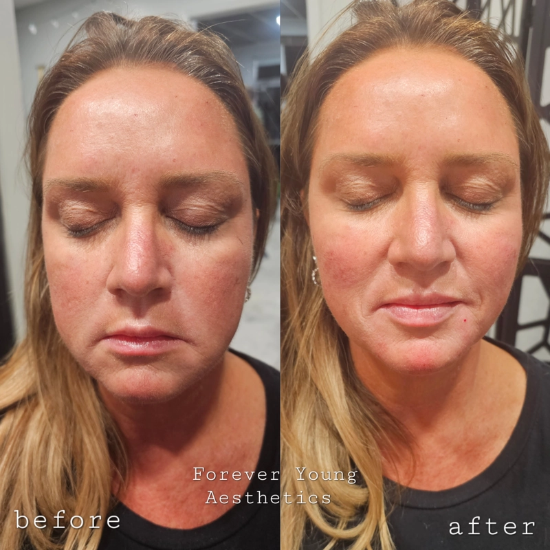 Before & After 7
