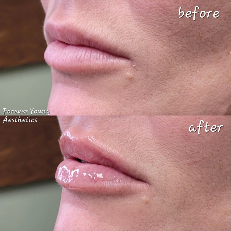 Before & After 10