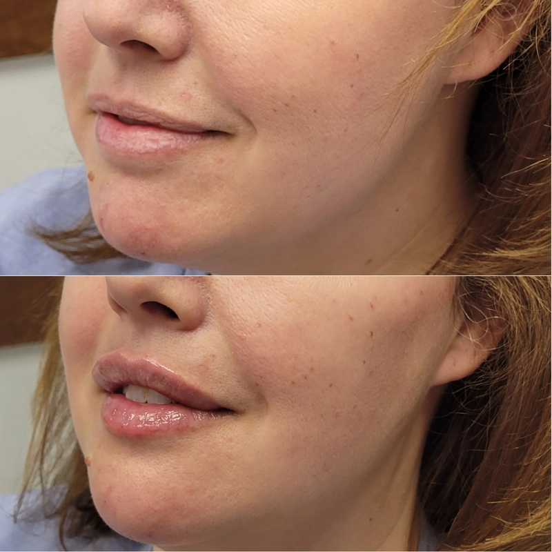 Before & After 9