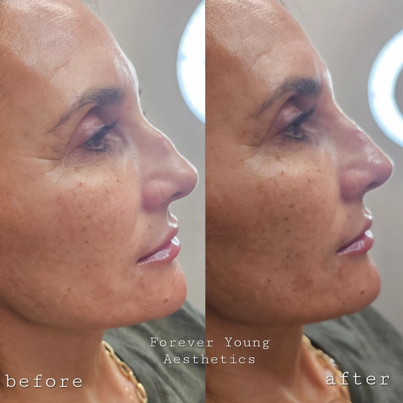 Before & After 11