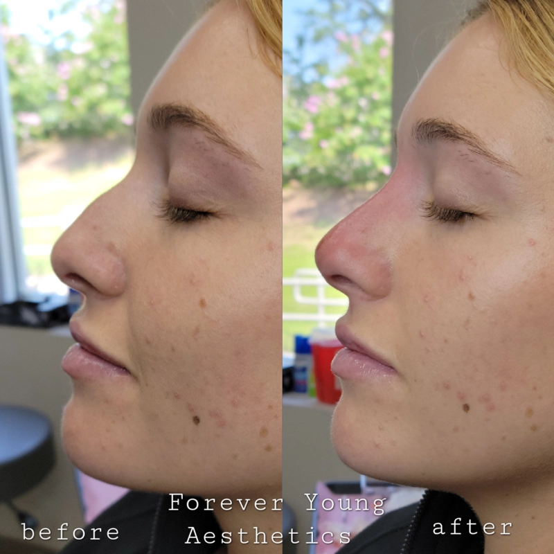 Before & After 12