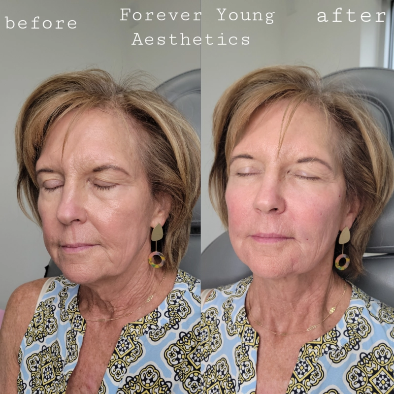 Before & After 14