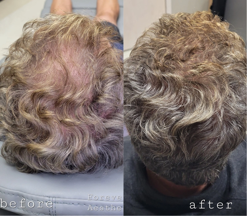 Before & After 15