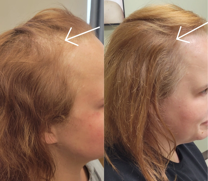 Before & After 16
