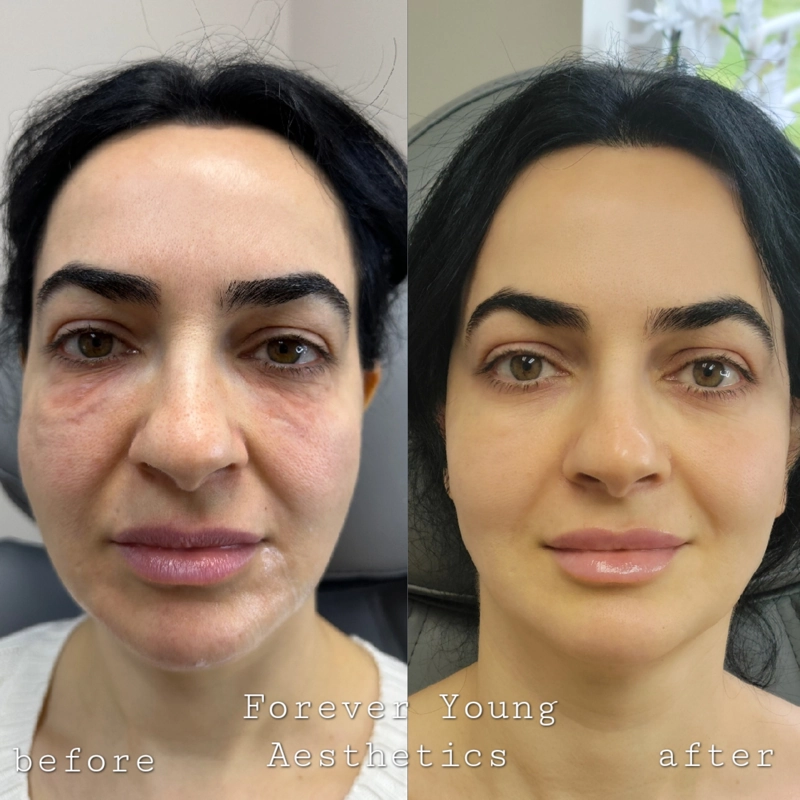 Before & After 19