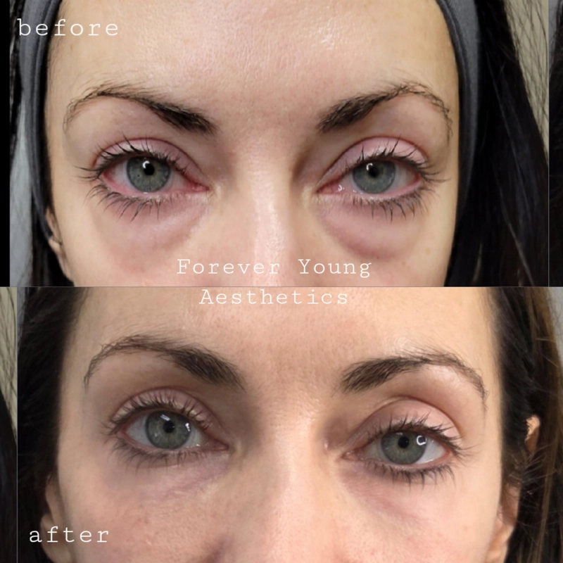 Before & After 20