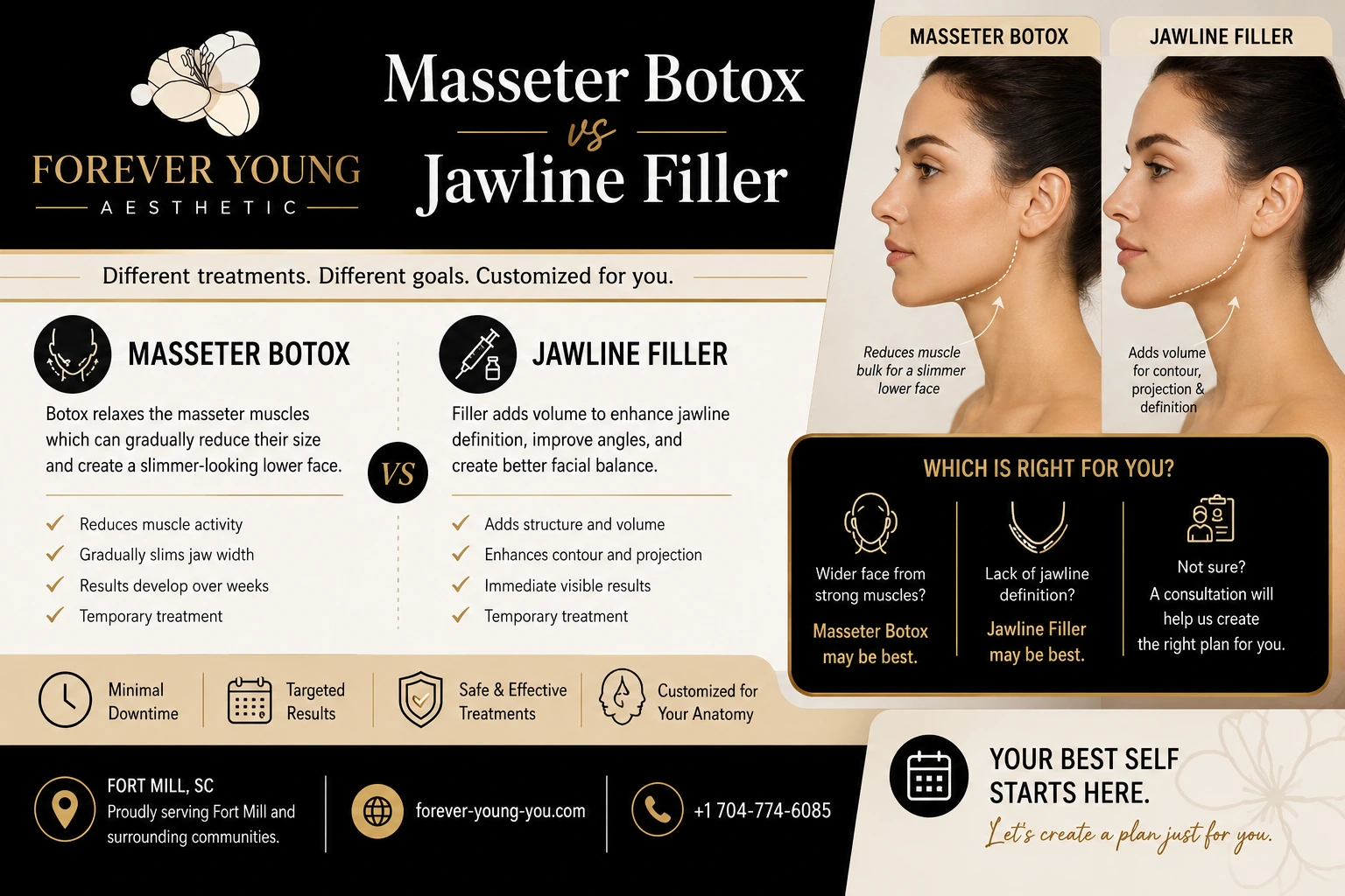 Masseter Botox vs Jawline Filler